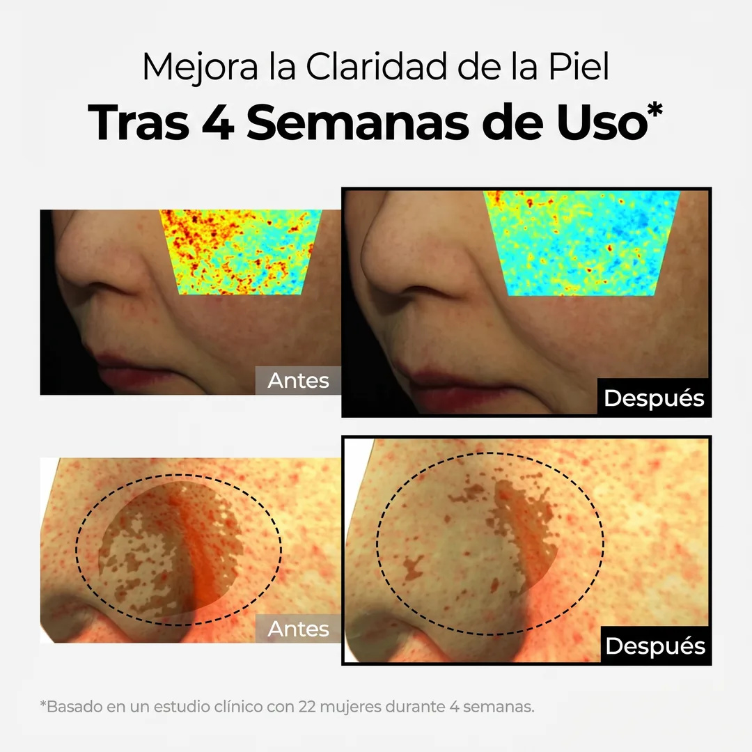 Crema Despigmentante Intensiva – Reduce Manchas y Unifica el Tono